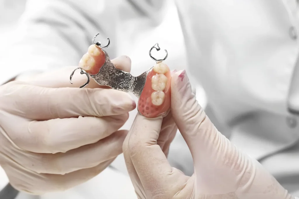 Gloved hands holding a tooth model with a removable restoration for patient education or treatment explanation
