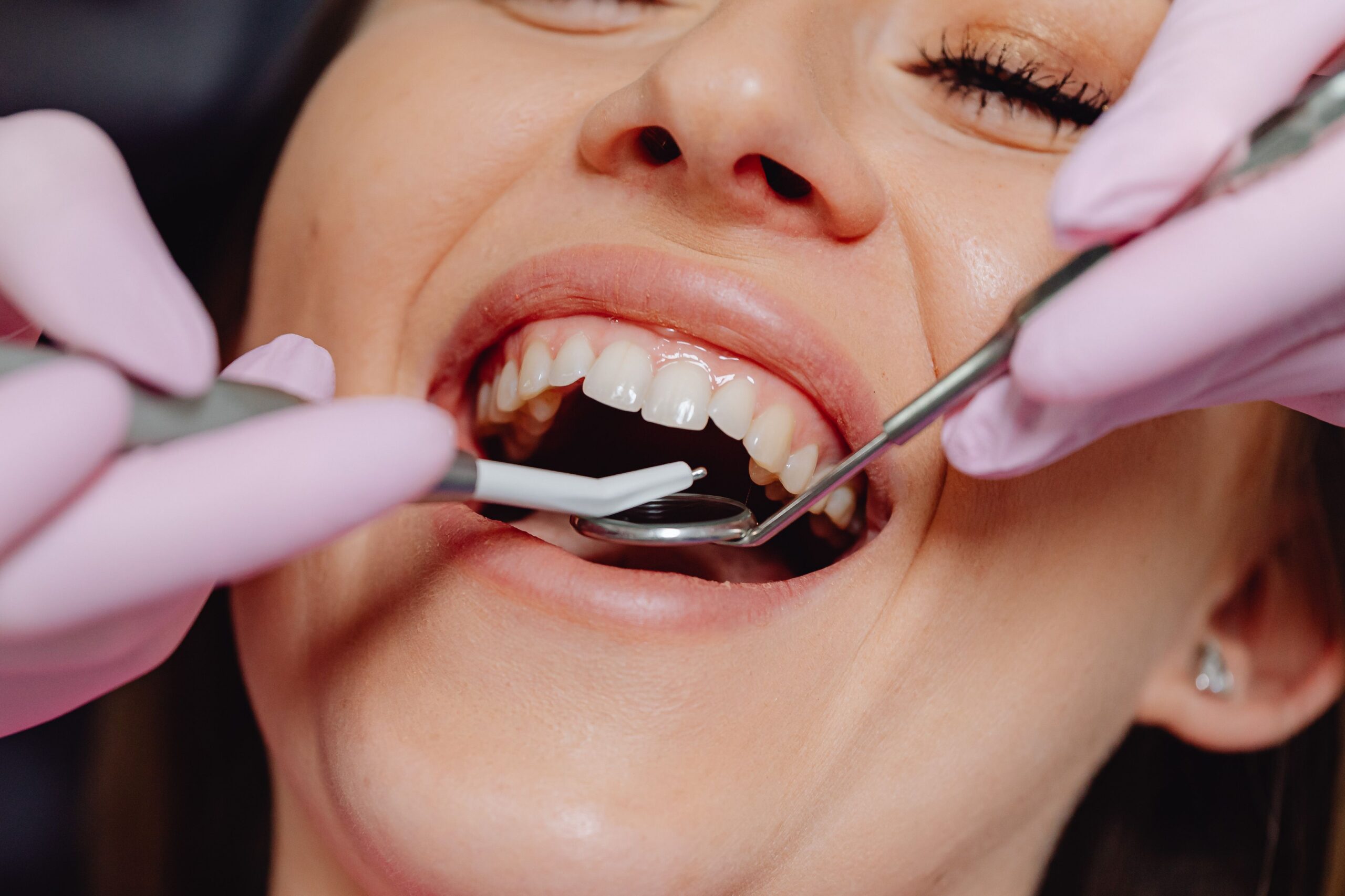 woman receiving a dental exam to evaluate gum health and signs of gum recession